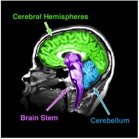 An MRI of the human brain delineating three major structures: the cerebral hemispheres, brain stem, and cerebellum.