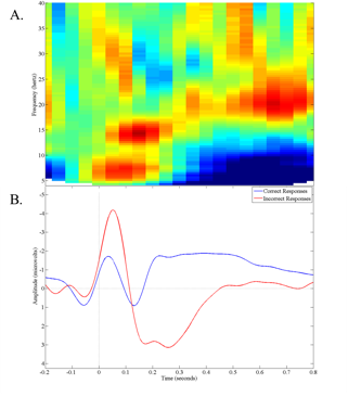 Example of EEG analysis output.