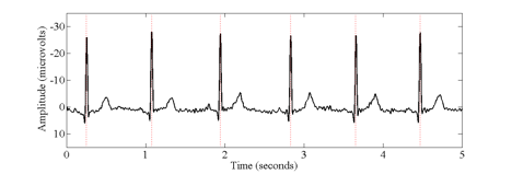 Ejemplo de forma de onda de electrocardiograma.