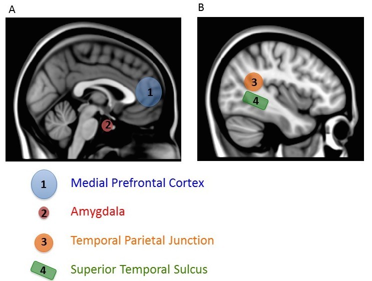 Two sagittal images of the brain.