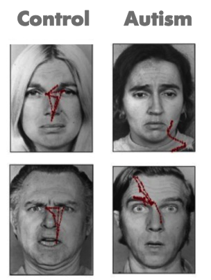Four faces are displayed each with red lines showing patterns of eye movements. The faces observed by study participants without autism show red lines in a roughly triangular pattern from the eyes to the mouth. The faces shown to participants with autism show lines with no discernible pattern and not focused near the eyes or mouth. 