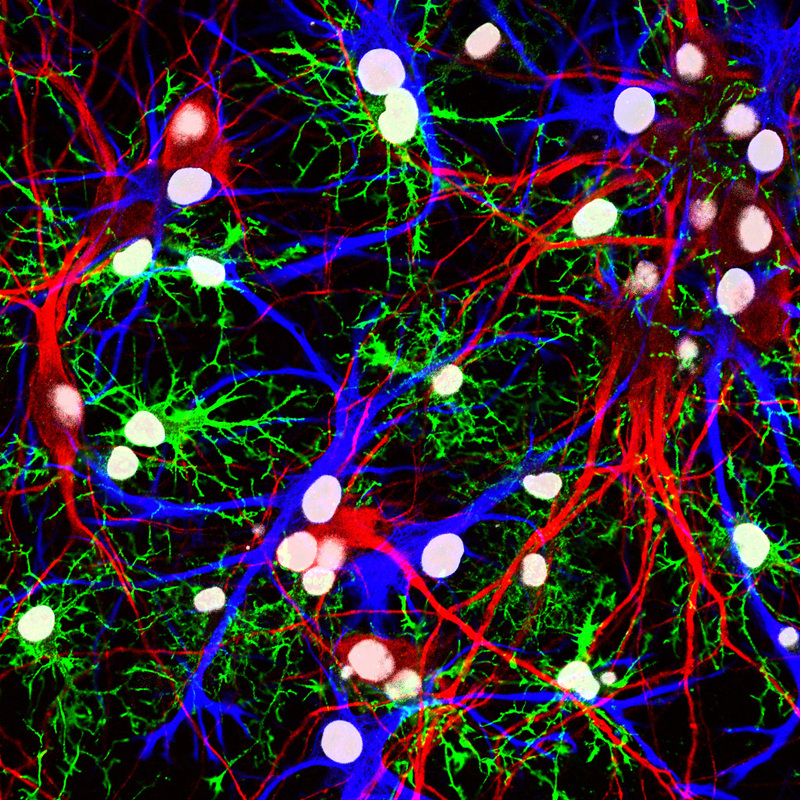 This image shows neurons and different types of glia from the hippocampus of a rat.