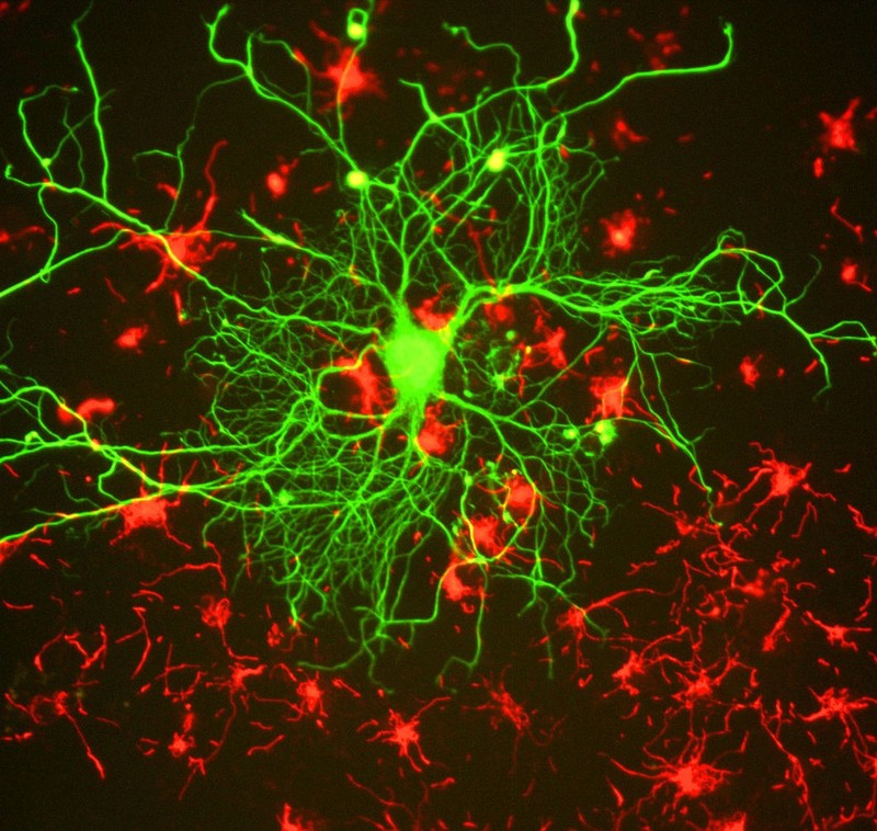 Cortical neuron tissue