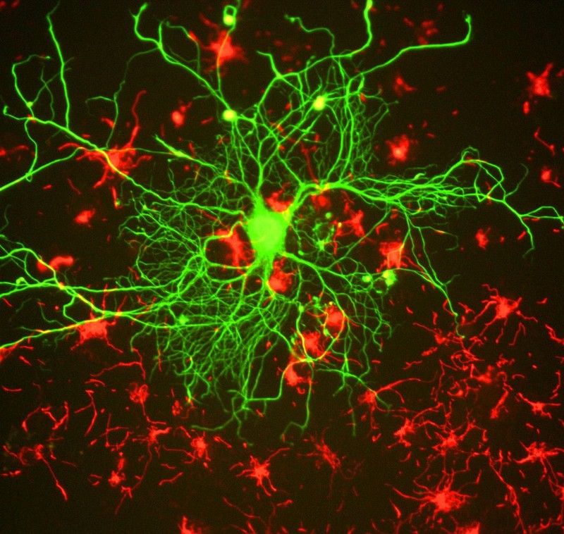 Tejido de neurona cortical