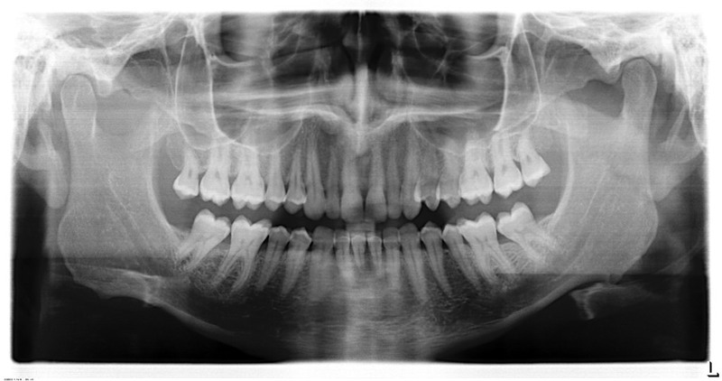 Radiografías dentales de un adulto.