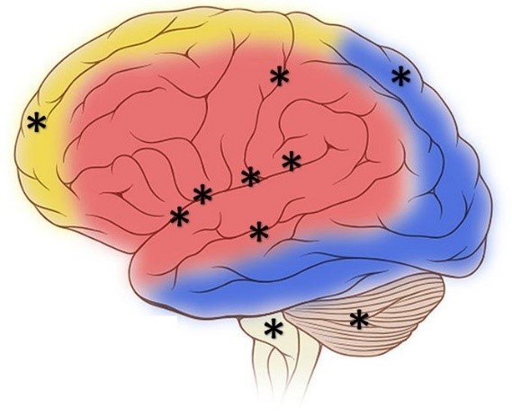 Diagrama de un cerebro humano con puntos distribuidos en un rango de ubicaciones -frontal, central, posterior, base- que indican áreas asociadas con el placer.