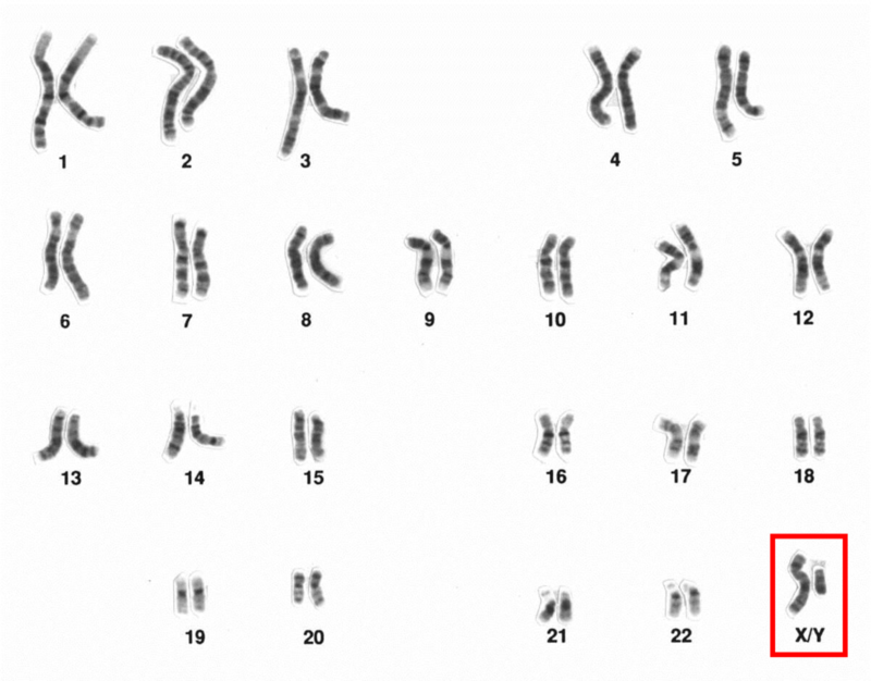 Microscopic image of human male chromosomes, sex chromosomes highlighted.