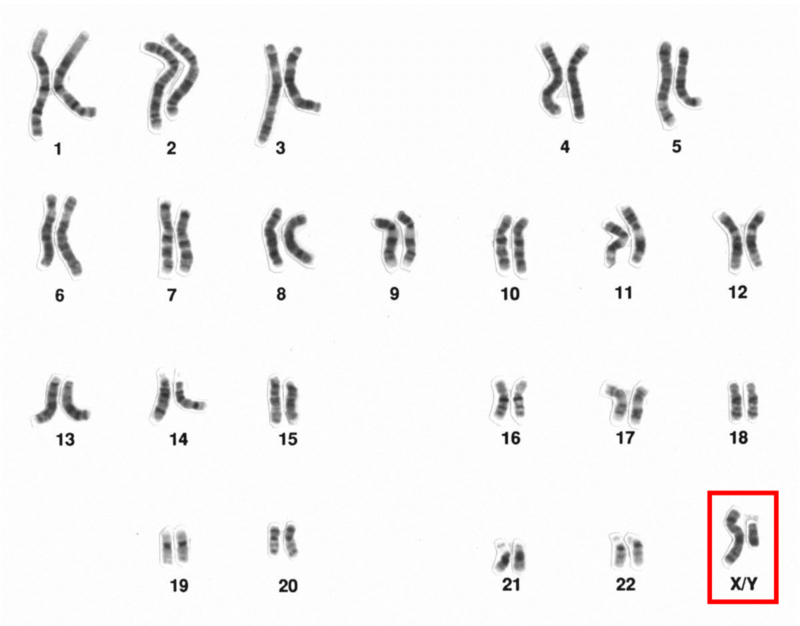 Imagen microscópica de cromosomas masculinos humanos, resaltados cromosomas sexuales.